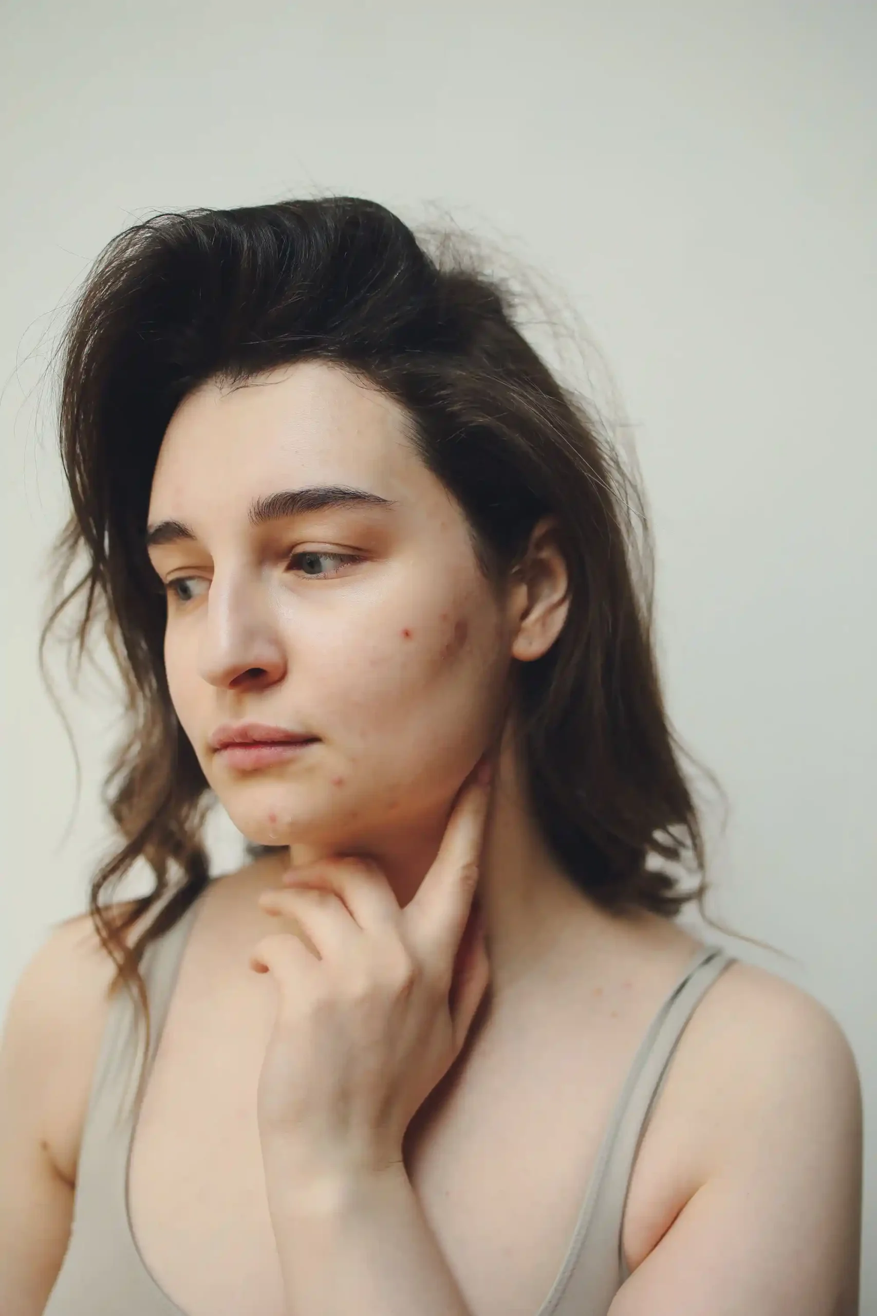 Why Your Skin Changes in Your 30s: Hormonal Acne, Skin Changes, and How to Prevent Breakouts