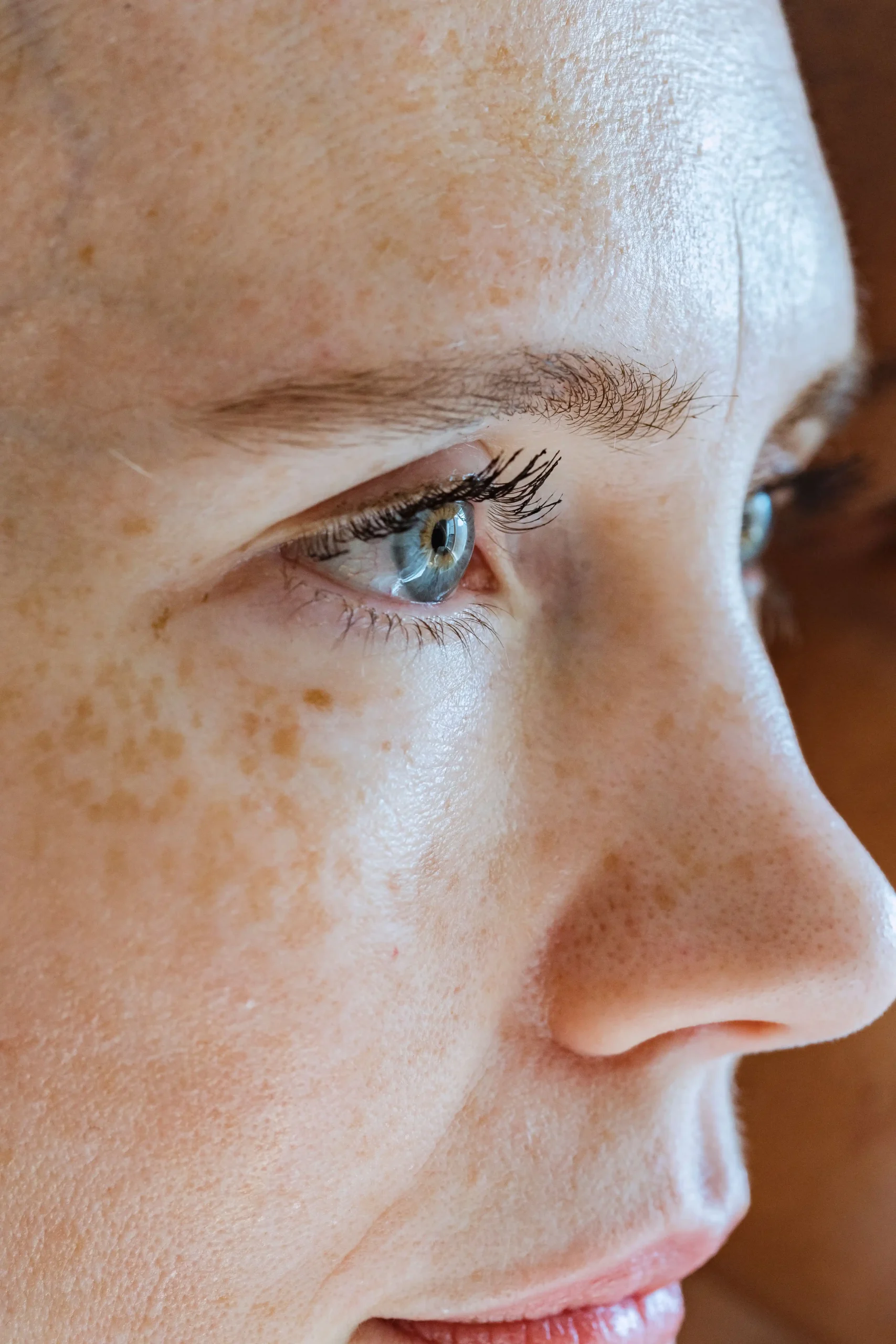Why Your Melasma Keeps Coming Back: Skincare Habits That Could Be Making Dark Spots Worse